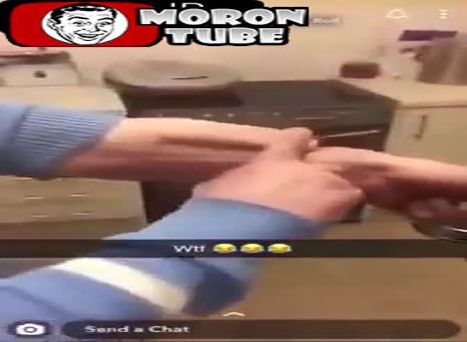 Video :Man gets penis transplanted onto forearm